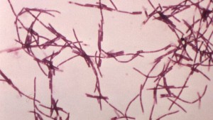 রংপুরে অ্যানথ্রাক্স ছড়াচ্ছে, তিন উপজেলায় রোগী শনাক্ত