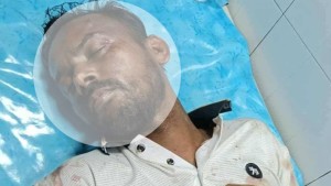 আফতাবনগরে হামলার শিকার হিরো আলম